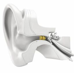 Phonak Lyric